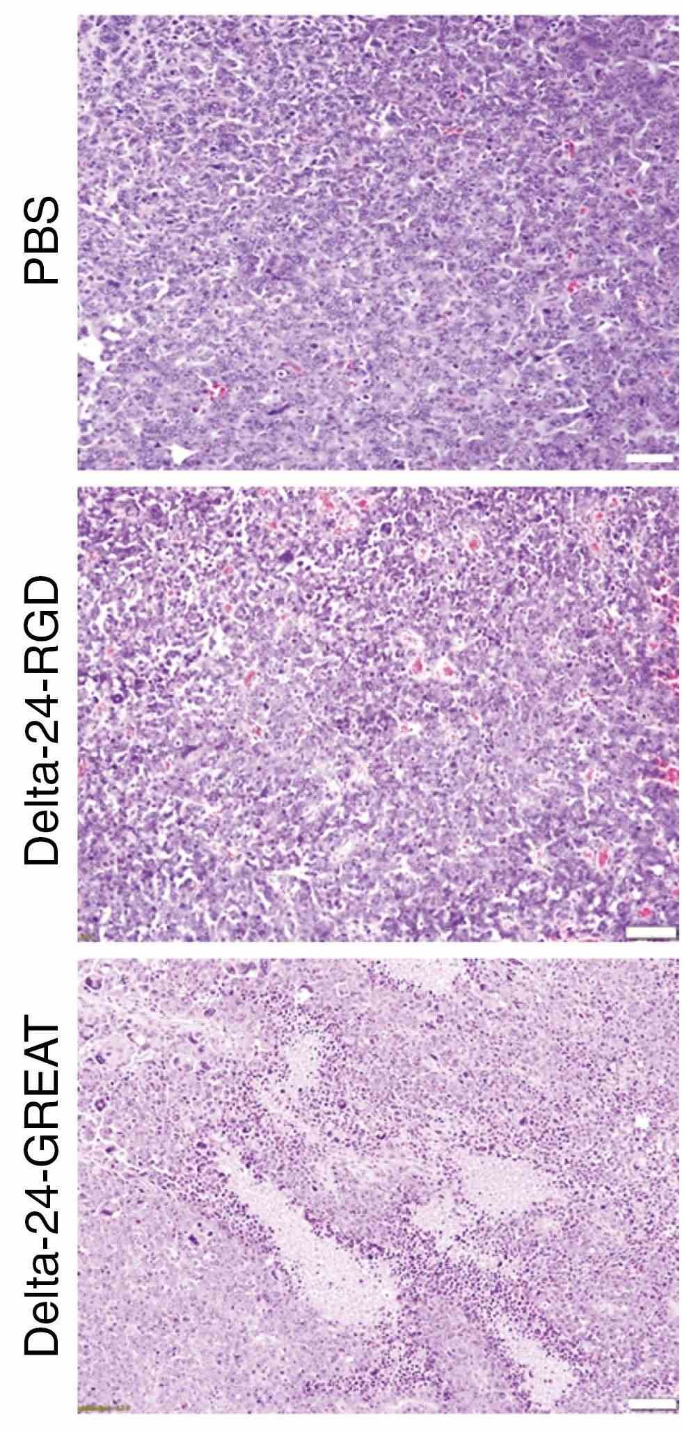 Histopathological analysis was performed after staining of tumor sections. (OA Literature)